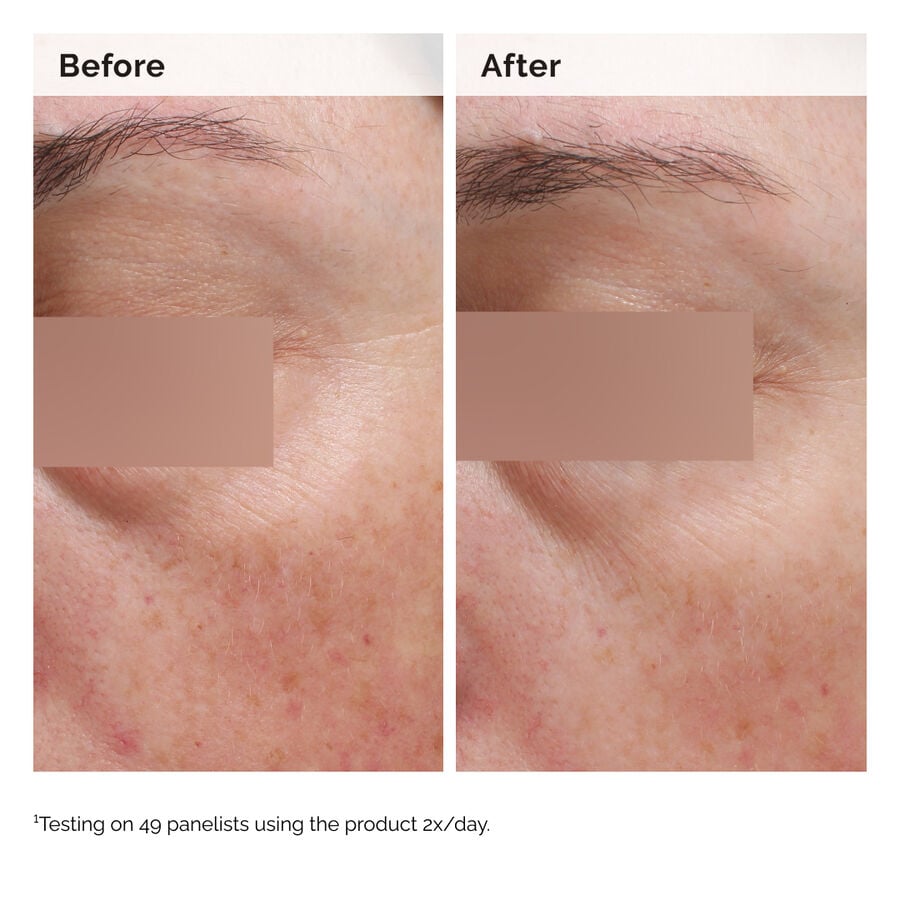 niacinamide-5-face-and-body-emulsion-j2 2024-08-23-ORD-Nia-5pct-Face-Body-B-A-Elasticity-Global-02-1x1.jpg