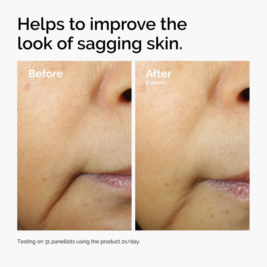 caffeine-3-escin-1-face-serum-f3 ord-caffeine-3pct-escin-1pct-face-serum-before-after-sagging.jpg