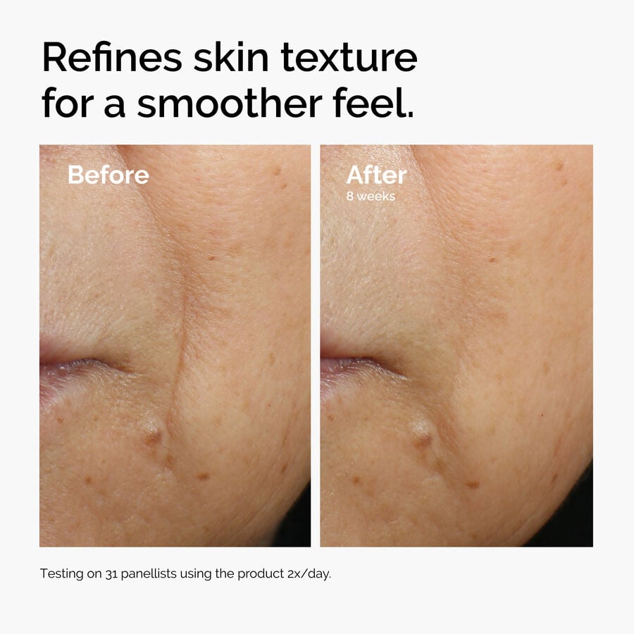 caffeine-3-escin-1-face-serum-f3 ord-caffeine-3pct-escin-1pct-face-serum-before-after-texture.jpg