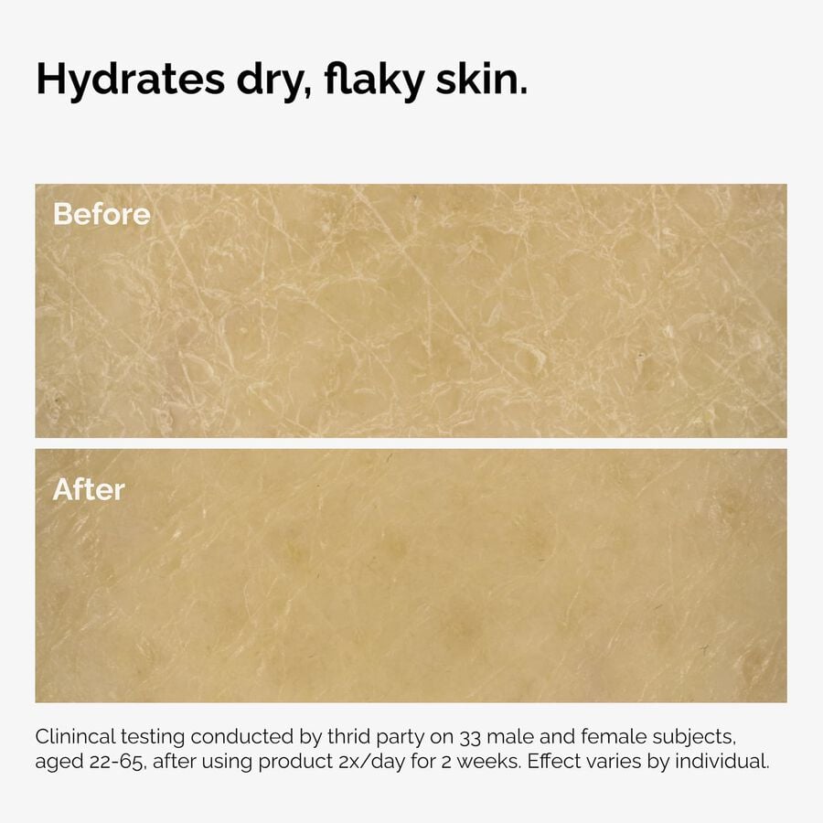the-body-care-collection-d2 ord-natural-moisturizing-factors-inulin-body-before-after-graphic-02.jpg