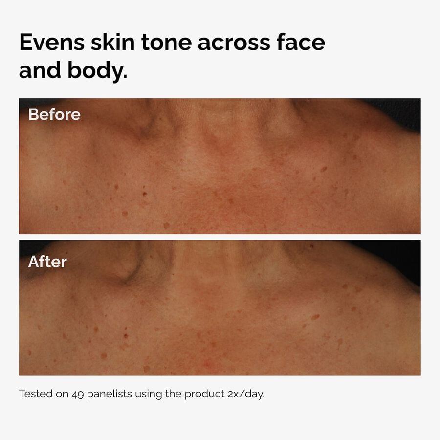 the-body-care-collection-d2 ord-niacinamide-face-body-serum-before-after-even-tone-graphic.jpg