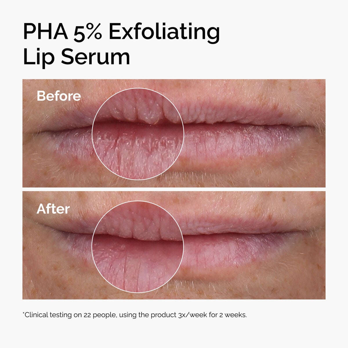 pha-5-exfoliating-lip-serum-n2 ord-pha-5pct-lip-exfoliating-serum-before-after.jpg