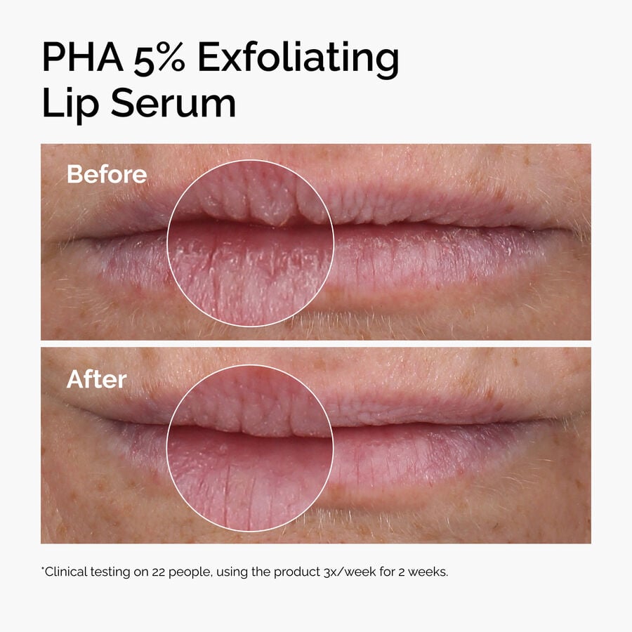 pha-5-exfoliating-lip-serum-n2 ord-pha-5pct-lip-exfoliating-serum-before-after.jpg